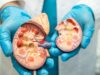 kidney failure kills. Avoid doing these dangerous things