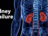you’re slowly destroying your kidney if you keep doing these
