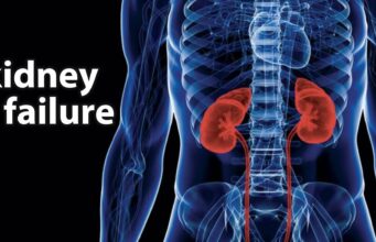 you’re slowly destroying your kidney if you keep doing these