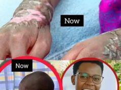 SDA singer Mary Clare seeks 5 million for india treatment after acid attack